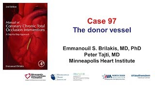 Case 97 Manual of CTO Interventions The Donor Vessel [upl. by Catlin]