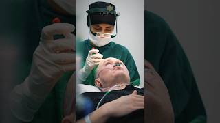 Hair transplants surgery here in sule clinic [upl. by Danae215]