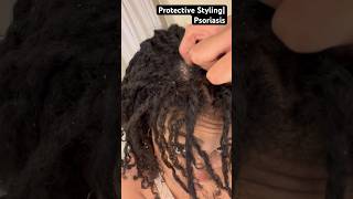 Protective Styling amp Psoriasis [upl. by Ongineb]