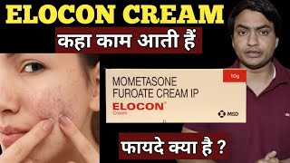 elocon cream  for dark spots  ke fayde  kaise use kare  use in hindi [upl. by Alwin]