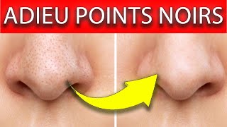 7 conseils pour avoir moins de points noirs [upl. by Deron]