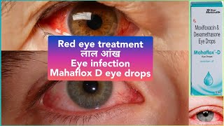 Mahaflox D eye drops moxifloxacin dexamethasone Red eye treatment लाल आंख [upl. by Jerrol]