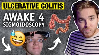 Sigmoidoscopy Story NO ANETHESIA  Ulcerative Colitis Diagnosis  My IBD Journey with UC [upl. by Eisak816]