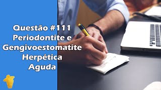 Periodontite e Gengivoestomatite Herpética Aguda  Características Clínicas  Questão 111 [upl. by Main257]