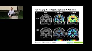 Neurobiologische Grundlagen psychischer Störungen [upl. by Essej]