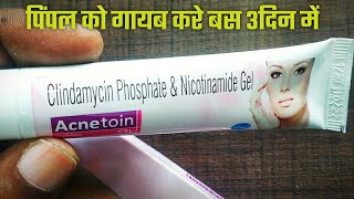 Acnetoin gel  Acnetoin  acnetoin gel uses in hindi  Clindamycin phosphate gel acnetoin gel price [upl. by Egap]