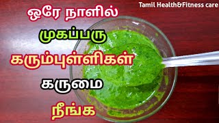 ஒரே நாளில் முகப்பருகருமைகரும்புள்ளிகள் நீங்கRemove pimples overnight homeremedies in tamil [upl. by Rella191]