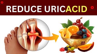 Top 8 Foods That Reduce Uric Acid Levels Naturally [upl. by Atiekram]