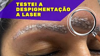 DESPIGMENTAÇÃO DE SOBRANCELHAS A LASER  TESTEI REMOÇÃO DE PIGMENTO A LASER REMOÇÃODETATUAGEM [upl. by Norra211]