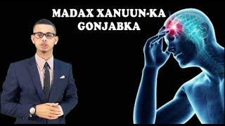 MADAX XANUUNKA GOONJABKA  Dhan jafka WAX YAABAHA KICYA IYO SIDA LOO DAAWEEYO Dr faris [upl. by Salene907]