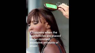 Naomi Campbell had Traction Alopecia [upl. by Aicined198]