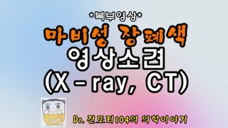 마비성 장폐색증paralyticadynamic ileus 영상소견abdominal Xray CT [upl. by Irot]