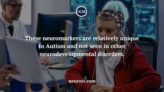 The Use of Neuromarkers in Diagnosing Autism [upl. by Weinberg]