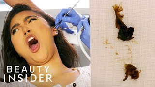 How Earwax Is Professionally Extracted  Beauty Explorers  Insider Beauty [upl. by Nashoma]