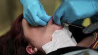 6g labret piercing procedure [upl. by Renee]