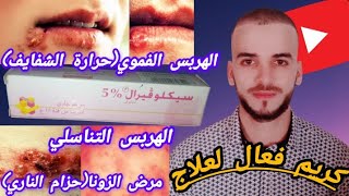 كل ما تريد معرفته عن كريم cicloviral 5٪ لعلاج الهربس الفموي والتناسلي ومرض الزوناالأسباب والأعراض [upl. by Seftton]