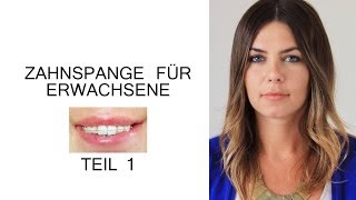 Zahnspange für Erwachsene  Der erste Schritt [upl. by Atkins]