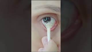 👉Contact Lens Lagane Ka Tarika How To Apply Contact Lenses Easy amp Simple contactlenses​ shorts [upl. by Ayaet]