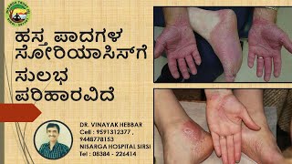 How To Cure Palmoplanter Psoriasis  Home Remedies for Palmoplanter Psoriasis  DR VINAYAK HEBBAR [upl. by Ahsieki]