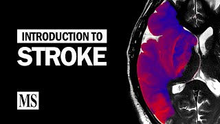 Introduction To Stroke [upl. by Glimp]