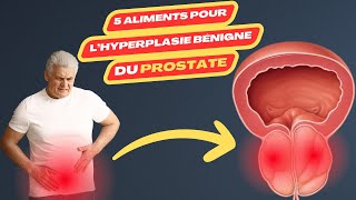 5 aliments pour lhypertrophie de la prostate  cancer prostate  prostate homme  prostatique [upl. by Norri649]