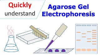 Agarose gel electrophoresis [upl. by Leveroni871]