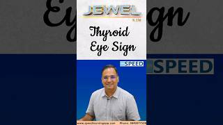 Thyroid Eye Sign by DrKVinayak Senthil neetpg neetss iniss inicet shorts doctor [upl. by Mosira]