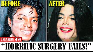 30 Times Plastic Surgery Went Horribly Wrong here goes my vote [upl. by Ihcelek]