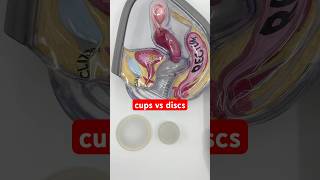 Menstrual Cups vs Menstrual Discs  quick overview shorts [upl. by Adalai]