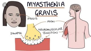 Role of Neostigmine in the treatment of Myasthenia Gravis [upl. by Miko]