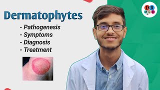 Dermatophytosis  Cutaneous mycosis  Dermatophytes  Microbiology bangla lecture [upl. by Sybilla516]