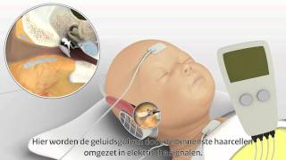 Gehoorscreening bij pasgeboren babys derde meting AABR Professionals [upl. by Ssac]