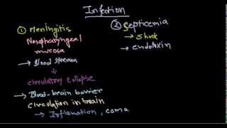 Neisseria meningitidis infection [upl. by Eetse]