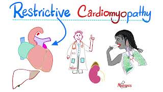 Restrictive Cardiomyopathy  Causes Symptoms Diagnosis amp Treatment  Cardiology Series [upl. by Acinomad]