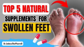 5 Effective Natural Supplements to Reduce Swollen Feet and Ankles Fast [upl. by Caasi222]