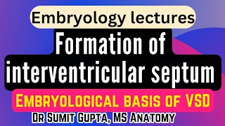 Interventricular septum  Ventricular septal defect  CVS embryology [upl. by Lada]