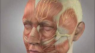 Migraine surgery video animation [upl. by Savdeep139]