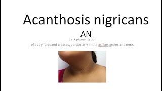 Medicine 1175 Acanthosis nigricans causes insulin resistance treatment skin dermatology dark line [upl. by Inat]