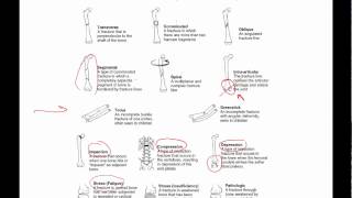 General principles of ortho trauma for PA students 1  basics [upl. by Bamberger168]