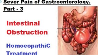 Intestinal Obstruction  Intussusception  Severe Pain in Abdomen  Homeopathic medicine [upl. by Noletta]