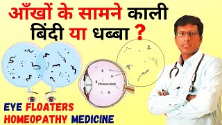 आँखों के सामने काली बिंदी या धब्बा Eye Floaters Homeopathy Medicine in Hindi by Dr Mahesh [upl. by Yrak]