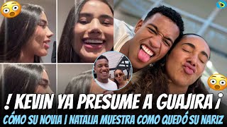 Kevin presume a Guajira como su novia  Natalia muestra como quedó su nariz la cual se operó [upl. by Demitria]