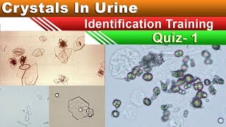 Crystals In Urine Identification Training Quiz  Part 15 [upl. by Aikimat]