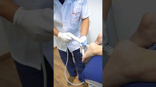 Fascitis Plantar Tratamiento con Ondas de Choque [upl. by Marrissa]