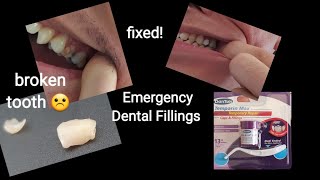 Toothache during COVID  No dentist  No problem Emergency Dental Filling Kit DENTEK Temparin Max [upl. by Gibrian625]