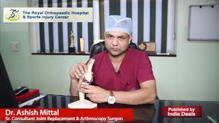 Ligament Injury Introduction By  Dr Ashish Mittal  लिगामेंट इंजरी क्या है चोट का कारगर इलाज [upl. by Bellanca]