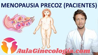 MENOPAUSIA PREMATURA o PRECOZ PACIENTES Necesidad de tratamiento  Ginecología y Obstetricia [upl. by Reinaldo]