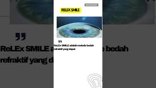 Femto lasik VS Relex smile [upl. by Iccir]