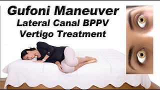 Gufoni Maneuver to Treat BPPV of the Lateral Canal Ageotropic and Geotropic Variations [upl. by Idona526]