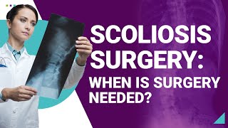 Scoliosis Surgery When is Surgery Needed [upl. by Nwahshar]